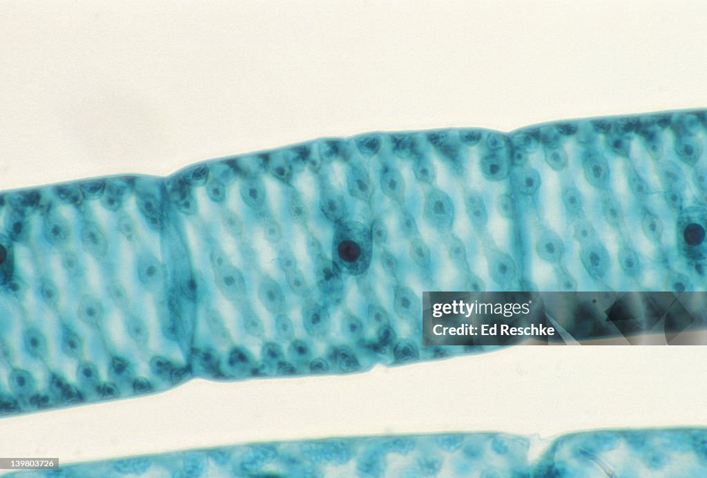 SPIROGYRA. GREEN ALGA. VEGETATIVE CELL. SHOWS NUCLEUS, SPIRAL CHLOROPLAST, PYRENOIDS. 100X at 35mm