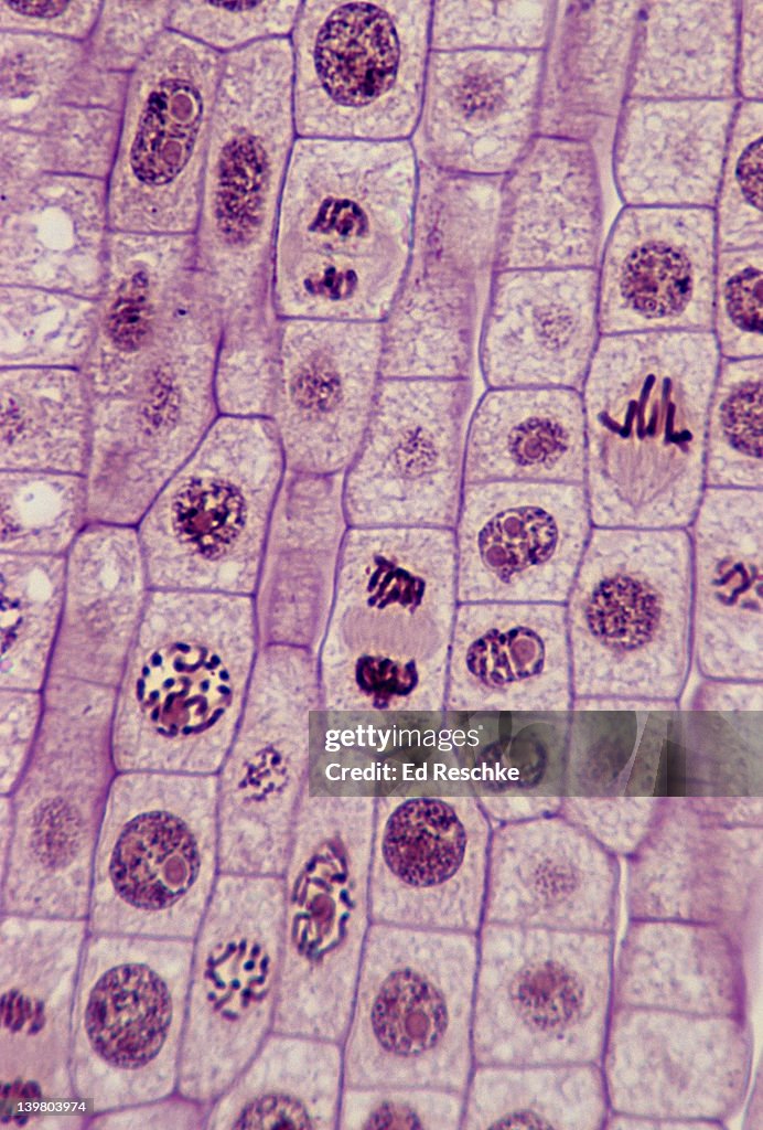 Mitosis Phases Onion Root Tip mitosis-phases-onion-root-tip