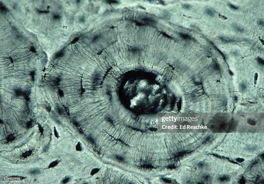 BONE (COMPACT); OSTEON OR HAVERSIAN SYSTEM, 100X at 35mm. Shows: osteonic (Haversian) canal, lamellae, canaliculi, & lacunae (black spaces, contains osteocytes in living bone). Bone is a supporting connective tissue, aka osseous tissue