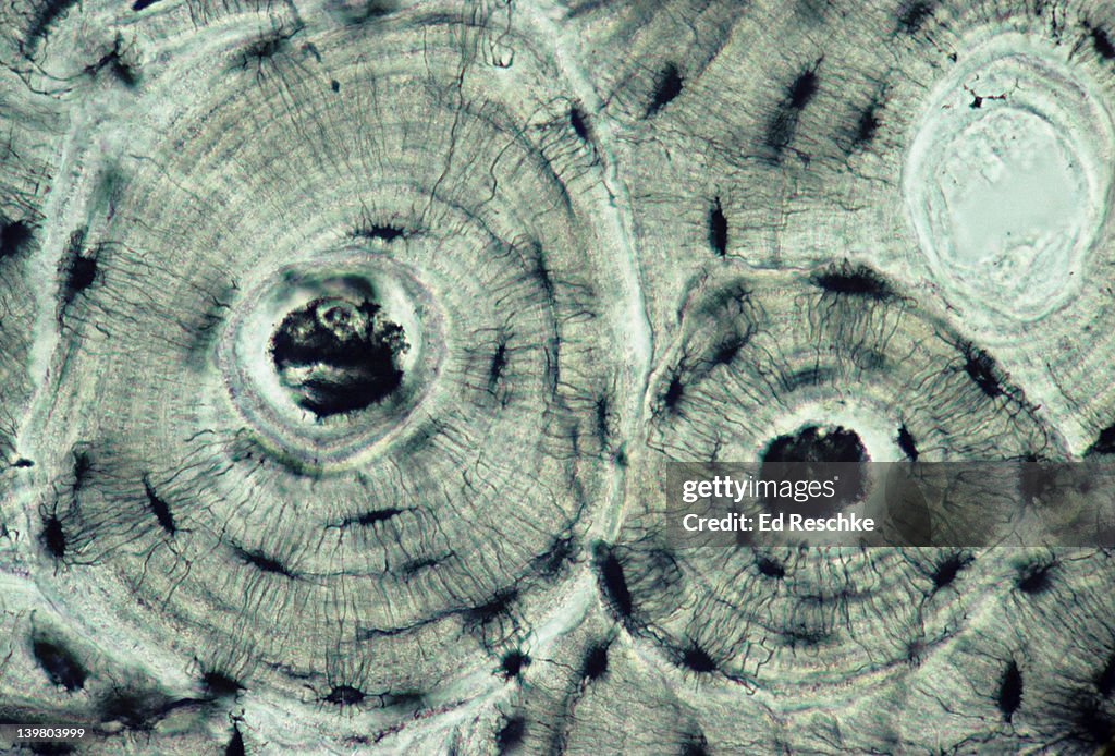 BONE (COMPACT); OSTEON OR HAVERSIAN SYSTEM, 100X at 35mm. Shows: osteonic (Haversian) canal, lamellae, canaliculi, & lacunae (black spaces, contains osteocytes in living bone). Bone is a supporting connective tissue, aka osseous tissue.
