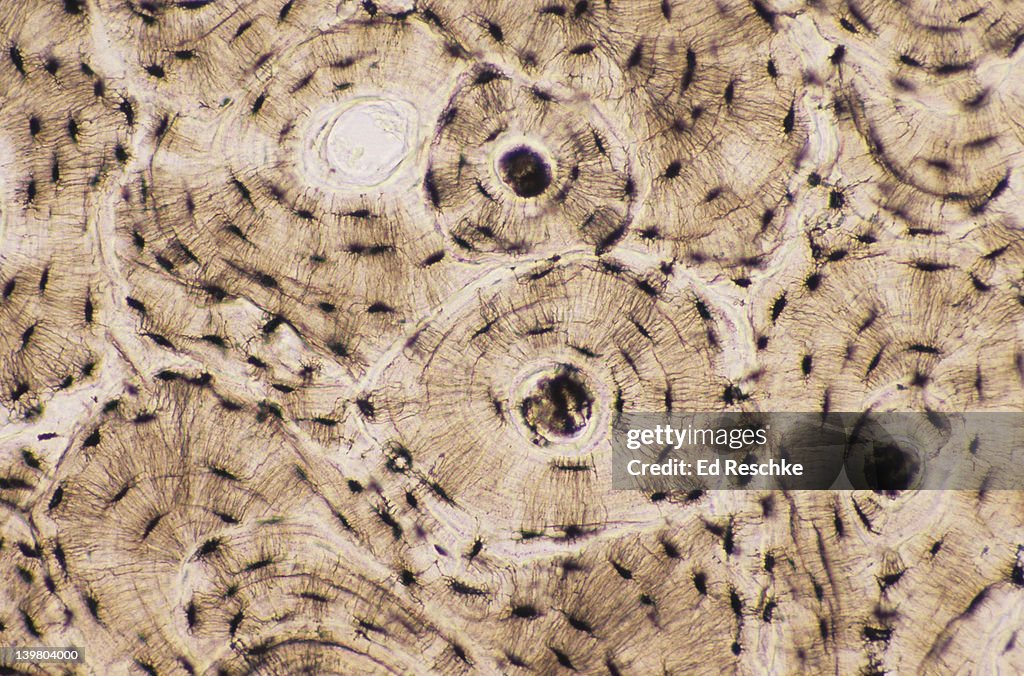 BONE (COMPACT), OSTEONS OR HAVERSIANS SYSTEMS, 50X at 35mm. Shows: osteonic (Haversian) canals, lamellae, canaliculi, & lacunae (dark spaces, contains osteocytes in living bone). Bone is a supporting connetive tissue aka osseous tissue.