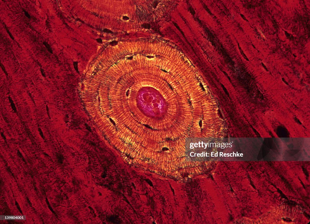 BONE, COMPACT; OSTEON OR HAVERSIAN SYSTEM, 100X at 35mm. Shows: osteonic (Haversian) canal with blood vessels, lamellae, canaliculi, & lacunae with osteocytes. Bone is a supporting connective tissue, also called osseous tissue.
