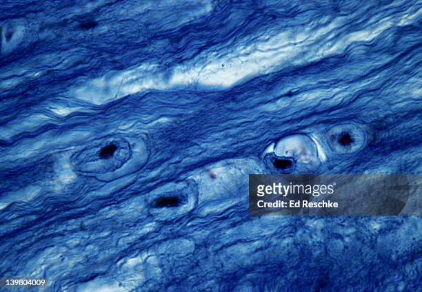 fibrocartilage; intervertebral disk, 250x at 35mm. shows:  collagenous fibers (wavy, very tough fibers) in the matrix, chondrocytes (cartilage cells), and lacunae. - microbiology stock pictures, royalty-free photos & images