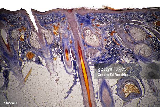 human scalp, shows: epidermis, dermis, hair follicles, sebaceous glands & subcutaneous layer. 10x at 35mm - human skin cell stock pictures, royalty-free photos & images