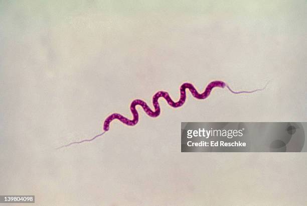 spirillum volutans. large spiral shaped bacterium. mobile. has flagellae. 400x at 35mm - spirillum stockfoto's en -beelden
