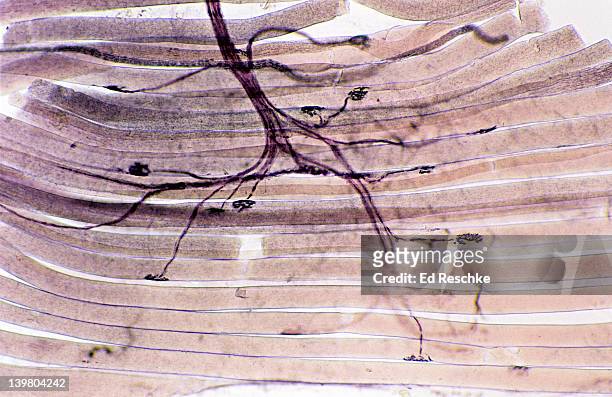 neuromuscular junctions, motor neurons, skeletal muscle fibers (cells) 25x at 35mm - motor neuron stock-fotos und bilder
