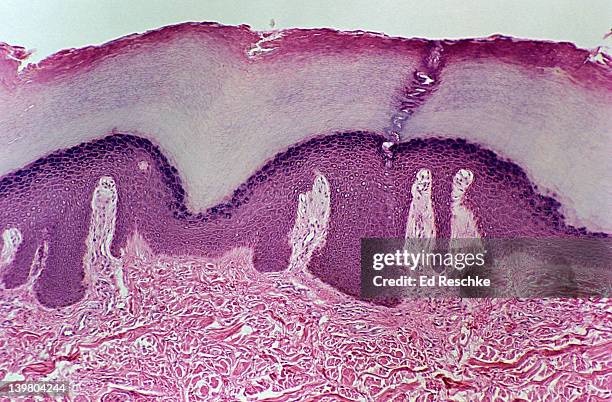 thick skin of palm. layers of epidermis, dermis, sweat glands duct. 25x at 35mm  - human gland 個照片及圖片檔