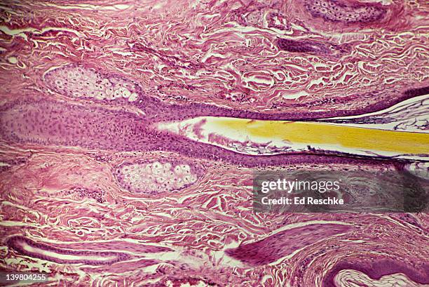 human scalp, shows: hair follicle, hair shaft, sebaceous glands, dermis & arrector pili muscle. 25x at 35mm - microphotographie immunofluorescente photos et images de collection