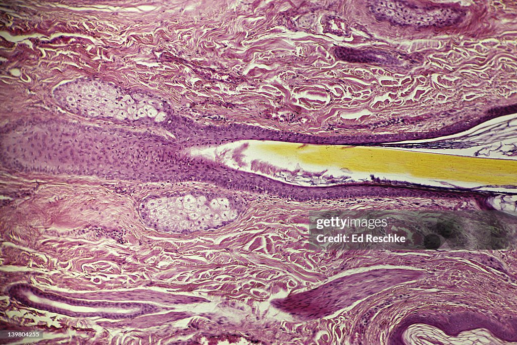 Human scalp, shows: hair follicle, hair shaft, sebaceous glands, dermis & arrector pili muscle. 25x at 35mm
