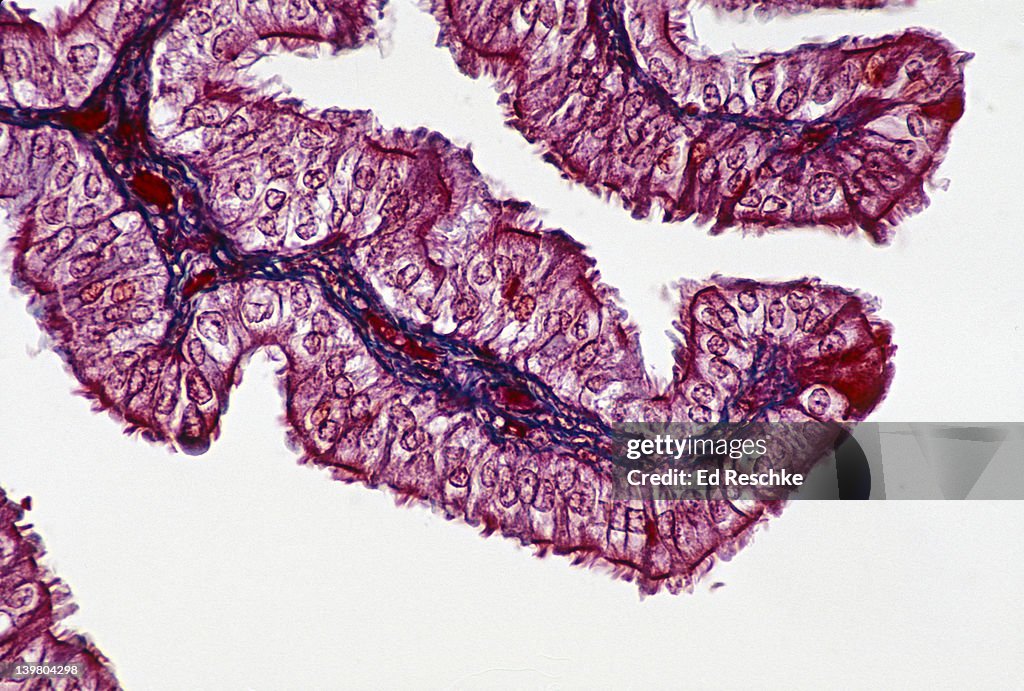 Simple columnar ciliated epithelium, fallopian (uterine) tube; mallory stain, mucosal fold, 100x at 35mm