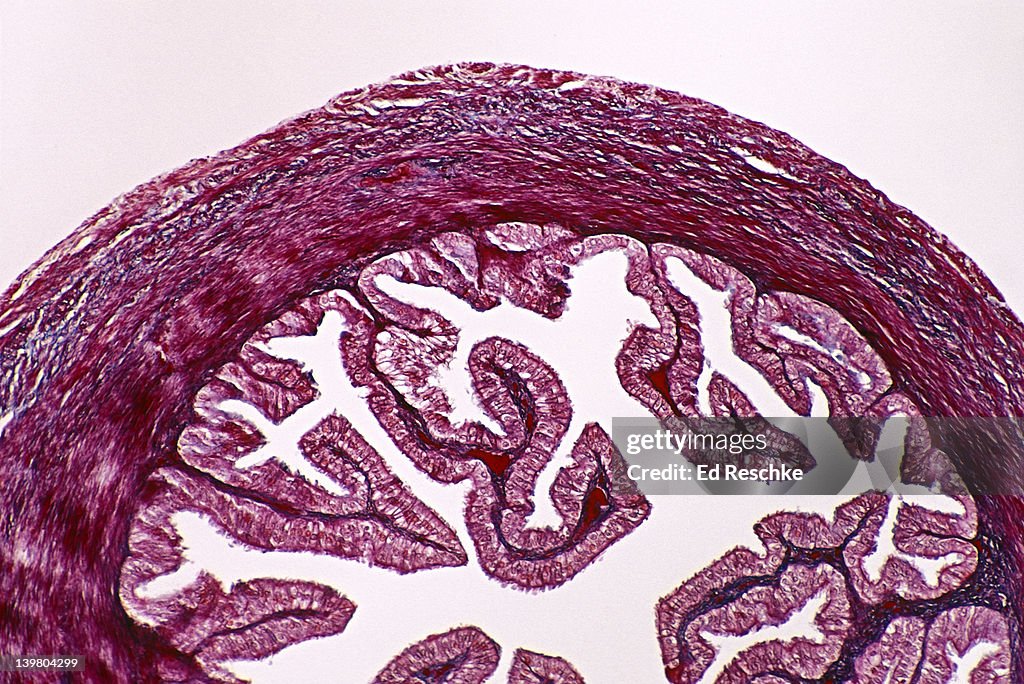 Simple columnar ciliated epithelium; fallopian (uterine) tube; lumen, mallory stain; mucosal folds. 25x at 35mm
