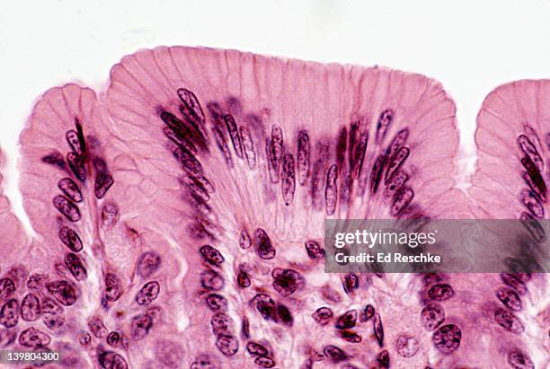 simple columnar epithelium of gastric mucosa, human. 250x at 35mm  - tejido epitelial fotografías e imágenes de stock