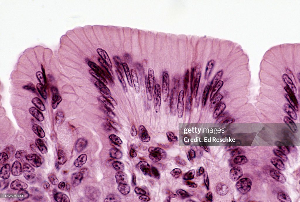Simple columnar epithelium of Gastric mucosa, Human. 250x at 35mm