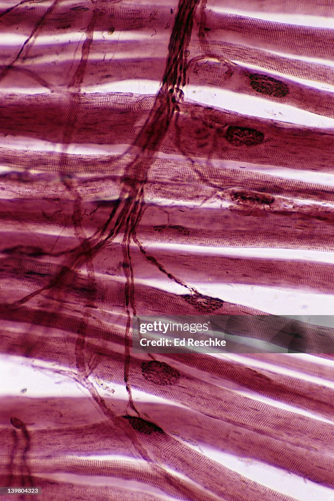 Neuromuscular junctions (motor end plates) on skeletal muscle. Shows neuromuscular junctions and motor neurons. 50X at 35mm