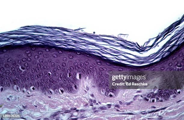 thin skin-epidermis, dermis, cornified layer - lederhuid stockfoto's en -beelden