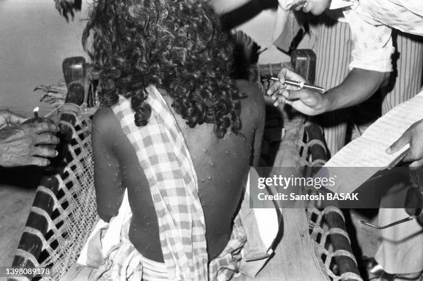 Un infirmier traite une personne atteinte de variole, en juillet 1974.