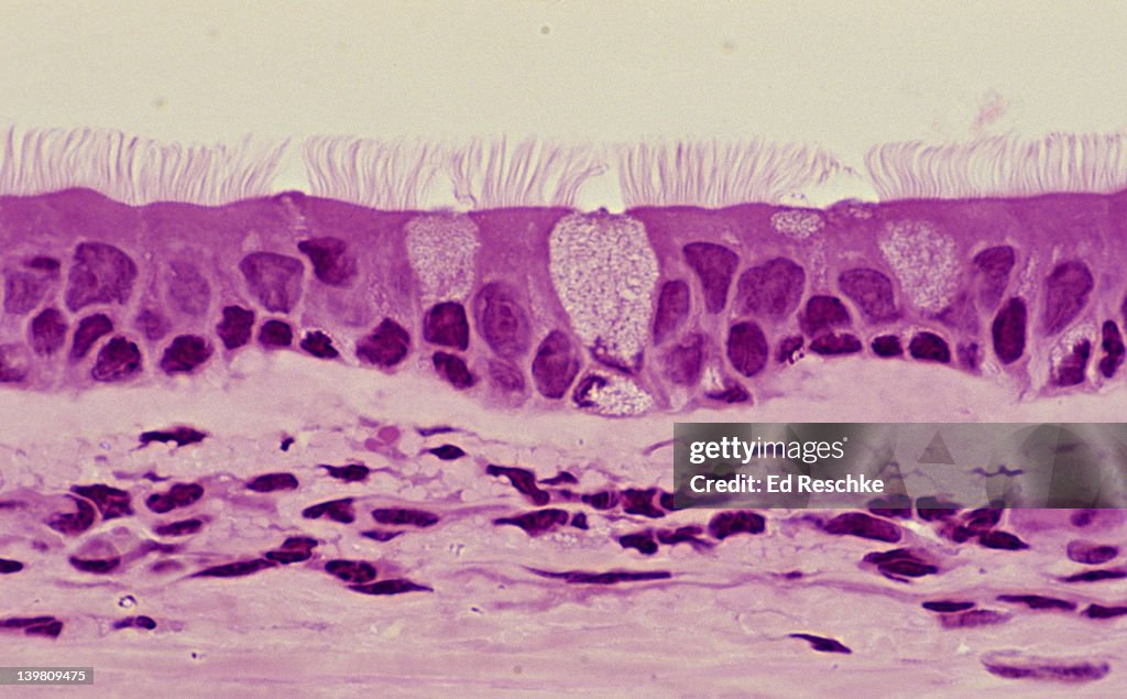 PSEUDOSTRATIFIED CILIATED COLUMNAR EPITHELIUM (TRACHEA, Human, 250x) Shows: cilia, pseudostratifed structure, goblet cells with mucous, basement membrane, and supporting connective tissue below.