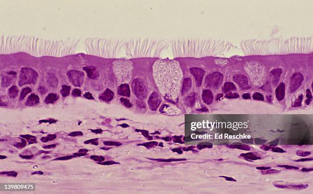 pseudostratified ciliated columnar epithelium (trachea, human, 250x) shows: cilia, pseudostratifed structure, goblet cells with mucous, basement membrane, and supporting connective tissue below. - epitelio imagens e fotografias de stock