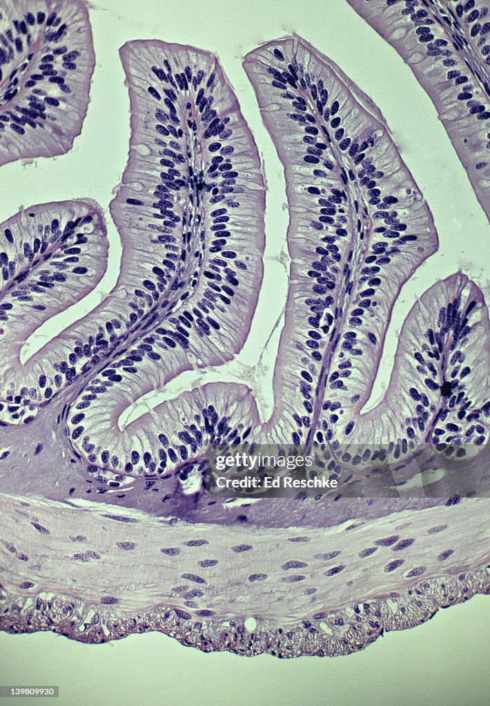 SMALL INTESTINE WITH VILLI AND LAYERS (OR TUNICS) 25X. Shows: villi, simple columnar epithelium, goblet cells with mucous, submucosa, muscularis (smooth muscle--circular and longitudinal layers) serosa.