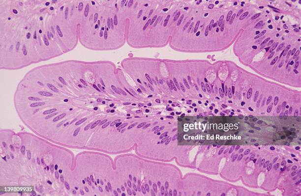 photomicrograph of villus of the ileum showing simple columnar epithelium, goblet cells, and striated border (microvilli); 100x. - intestino delgado - fotografias e filmes do acervo
