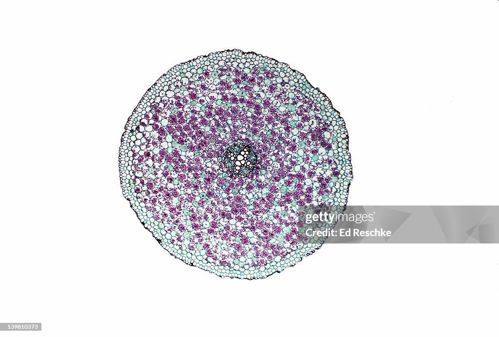 X-SECTION OF BUTTERCUP MATURE ROOT. RANUNCULUS. SHOWS STELE, XYLEM, PHLOEM, CORTEX, ENDODERMIS, STARCH GRAINS & EPIDERMIS. DICOT 10X