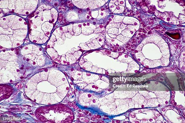 human simple cuboidal epithelium, kidney tubules, cross and longitudinal sections, (magnification x100) showing simple cuboidal epithelium forming kidney tubules (part of the nephron), lumen and blue connective tissue. mallory stain. - micrografía científica fotografías e imágenes de stock