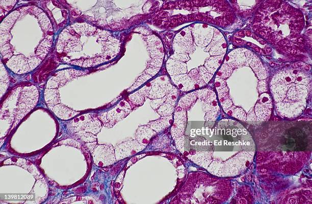 human simple cuboidal epithelium, kidney tubules, cross and longitudinal sections, (magnification x100) shows simple cuboidal epithelium forming kidney tubules (part of the nephron), lumen and blue connective tissue. a few of the tubules show flatter (squ - cuboidal epithelium stock pictures, royalty-free photos & images