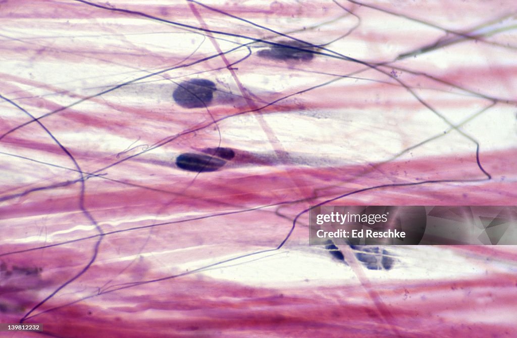 Areolar Connective Tissue (or Loose Connective Tissue). Magnification x250. Showing collagen fibres (large, pink fibres), elastic fibres (black), matrix and fibroblasts--cells that produce the fibres.