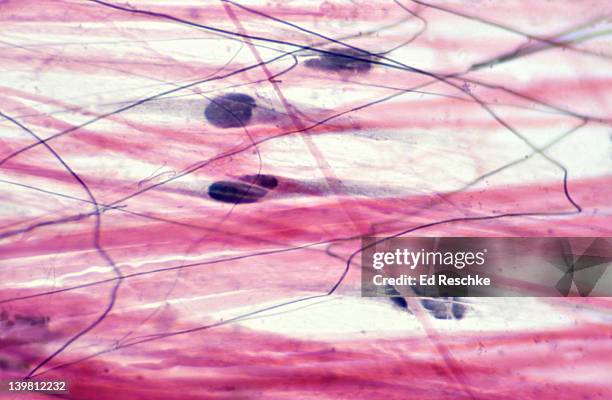 areolar connective tissue (or loose connective tissue). magnification x250. showing collagen fibres (large, pink fibres), elastic fibres (black), matrix and fibroblasts--cells that produce the fibres. - fibroblasto imagens e fotografias de stock