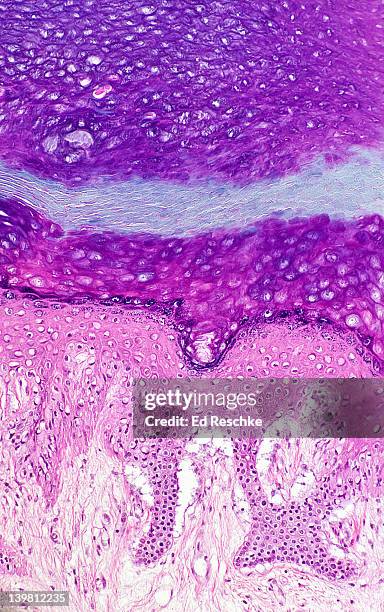 five epidermal layers (or strata) in thick skin, human. magnification x50. from bottom to top: stratum basale, stratum spinosum, stratum granulosum, stratum lucidum and stratum corneum. also shows the dermis below. - lederhuid stockfoto's en -beelden