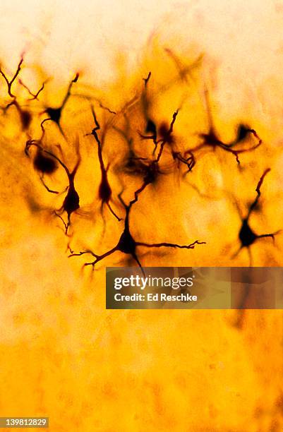 neurons (pyramidal cells), cerebral cortex (magnification x100) shows: neurons, cell bodies, and numerous nerve fibres that are mostly dendrites. fox-golgi stain. - prueba de tinción fotografías e imágenes de stock