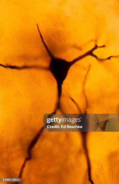 neuron (pyramidal cell), cerebral cortex (magnification x250) showing neuron, cell body and several nerve fibres that are mostly dendrites. fox-golgi stain. - immunofluorescentie microfoto stockfoto's en -beelden