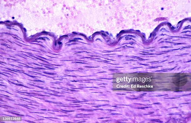 smooth muscle and endothelium in a muscular artery wall, (magnification x100). cross section of a muscular artery showing the smooth muscle in the extensive tunica media, the endothelium and internal elastic membrane (lamina) which compose the tunica inti - 平滑筋 ストックフォトと画像