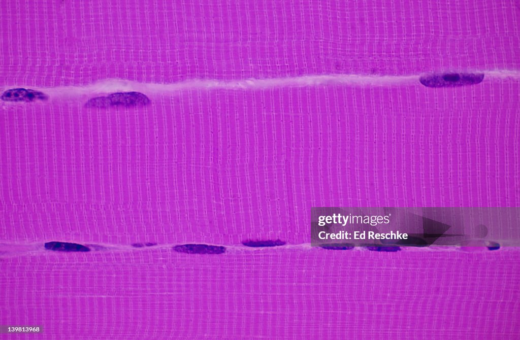 Multinucleated Tissue Skeletal Muscle Fibres Showing Three Muscle Fibres Or Cells Striations ...