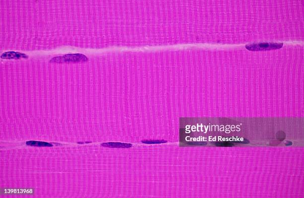 skeletal muscle fibres (cells) in longitudinal section (magnification x250). showing three muscle fibres or cells, striations, peripheral multinucleate nature of skeletal muscle cells, a bands, i bands, z lines, and endomysium. - peripheral artery stock pictures, royalty-free photos & images