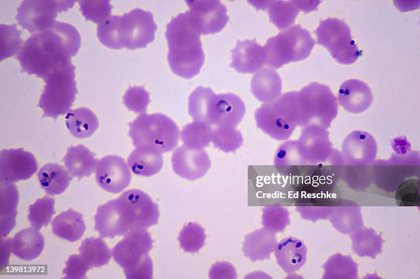 plasmodium falciparum in ring stage in human red blood cells. malarial parasite (magnification x 400) a protozoan parasite.  vector is the female anopheles mosquito the most dangerous species of plasmodium. - malaria parasite fotografías e imágenes de stock