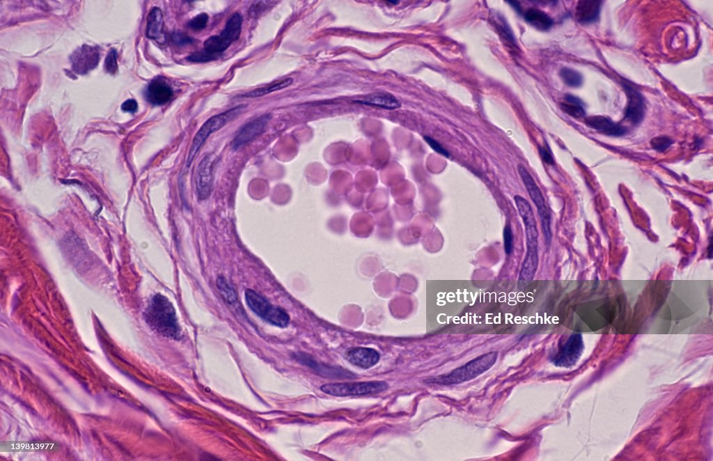 Arteriole, the smallest Artery on human scalp (Magnification x250) This arteriole shows all three tunics (or layers). Smooth muscle cells are prominent in the tunica media. The tunica intima shows the endothelium and nuclei. By vasoconstriction and va