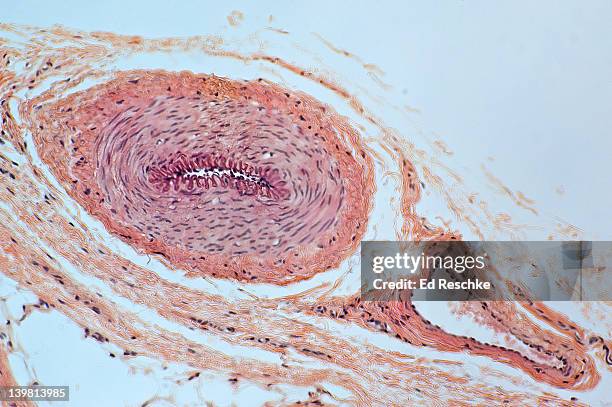 muscular artery and vein in cross section showing layers or tunics,  (magnification x 50).  the muscular artery shows the tunica intima and internal elastic membrane,  the tunica media (smooth muscle),  and the tunica adventitia.  the vein has a thinner w - microbiology stock pictures, royalty-free photos & images