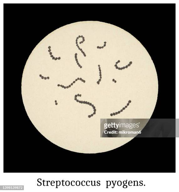 old chromolithograph illustration of magnification of bacteria streptococcus pyogens - spore stock pictures, royalty-free photos & images