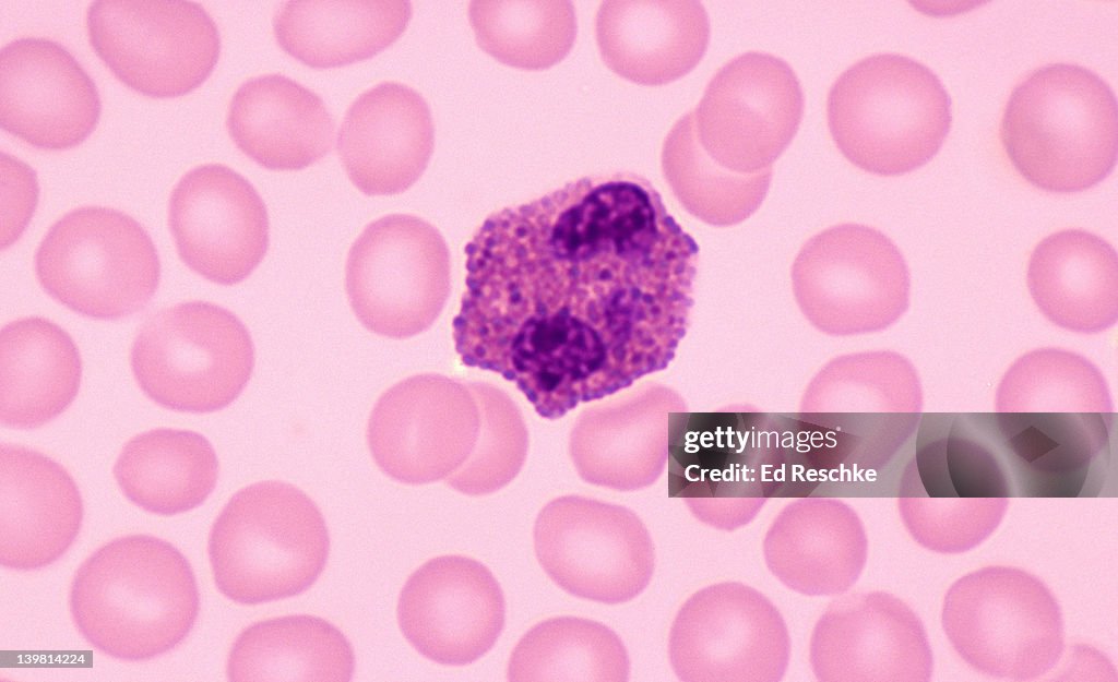 Eosinphil, white blood cell, human blood, (Magnification x400) Showing bilobed nucleus, and large cytoplasmic granules.