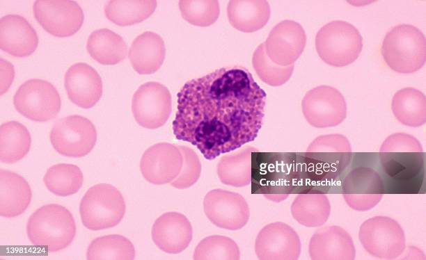 eosinphil, white blood cell, human blood, (magnification x400) showing bilobed nucleus, and large cytoplasmic granules. - eosinófilo imagens e fotografias de stock