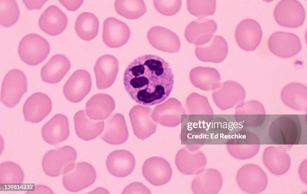 neutrophil, the most common white blood cell, human blood, (magnification x400) segmented (lobed) nucleus. excellent phagocyte. red blood cells, and one platelet (thromobocyte) visible - human blood stock pictures, royalty-free photos & images
