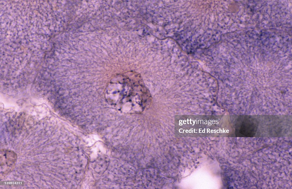 Interphase Magnification Whitefish Mitosis Interphase And Very Early Prophase Nucleus Nuclear ...