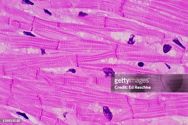 cardiac muscle with intercalated discs, human, (magnification x250). showing intercalated discs, striations, nucle and syncytium (branching, interconnected network of cells). involuntary muscle. h & e stain. - cardiac muscle tissue stock pictures, royalty-free photos & images