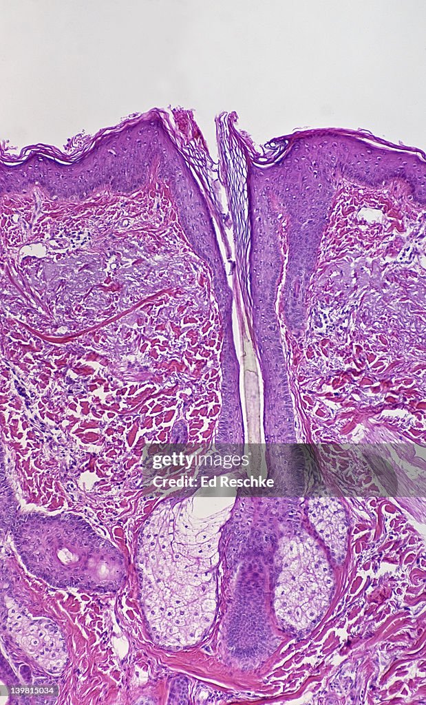 Sebaceous Glands and Hair Follicle of Human Scalp (Magnification x25) H & E stain. Showing hair follicle, hair, epidermis and dermis and arrector pili muscle