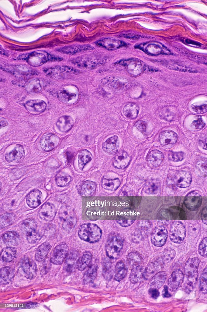 Keratinized Stratified Squamous Epithelium of Human Scalp Epidermis (Magnification x250) Showing the cellular structure of the epidermis; stratum basale, stratum spinosum, stratum granulosum (dark cells) and stratum corneum (heavily keratinized or cornif