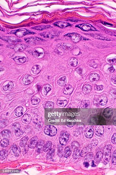 keratinized stratified squamous epithelium of  human scalp epidermis (magnification x250) showing the cellular structure of the epidermis; stratum basale, stratum spinosum, stratum granulosum (dark cells) and stratum corneum (heavily keratinized or cornif - hornskikt bildbanksfoton och bilder