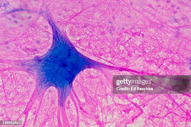 motor neuron (multipolar) with cell body and many processes (mostly dendrites), spinal cord (magnification x100). this multipolar motor neuron comes from the anterior (ventral) horn of the spinal cord grey matter. the stain is methylene blue and phloxine. - micrografía científica fotografías e imágenes de stock