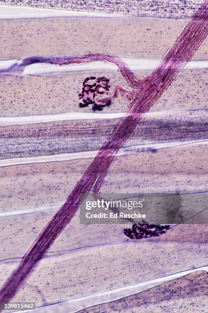 neuromuscular junctions, motor neurons and skeletal muscle fibres (cells). (magnification x100). showing two neuromuscular junctions, motor neuron axons and striations in the skeletal muscle fibres. - human skin cell stock pictures, royalty-free photos & images