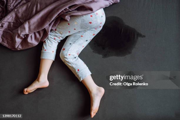 unrecognizable child legs on wet bed. incontinence problem - scham stock-fotos und bilder